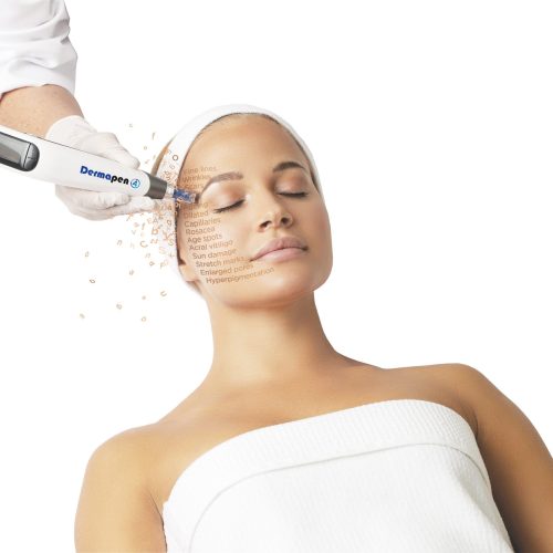 Dermapen4 with Nina Dermapen4 with Nina