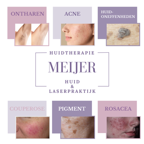 Huidtherapie Meijer collage_20241126_104845_0000 Huidtherapie Meijer collage_20241126_104845_0000