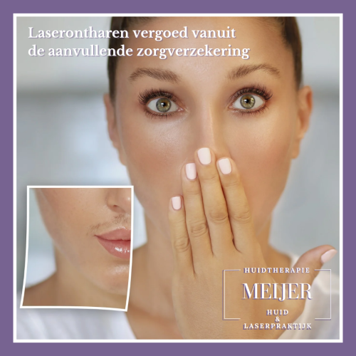 Kopie van Kopie van Kopie van Laserontharen_20250222_204027_0000 Kopie van Kopie van Kopie van Laserontharen_20250222_204027_0000