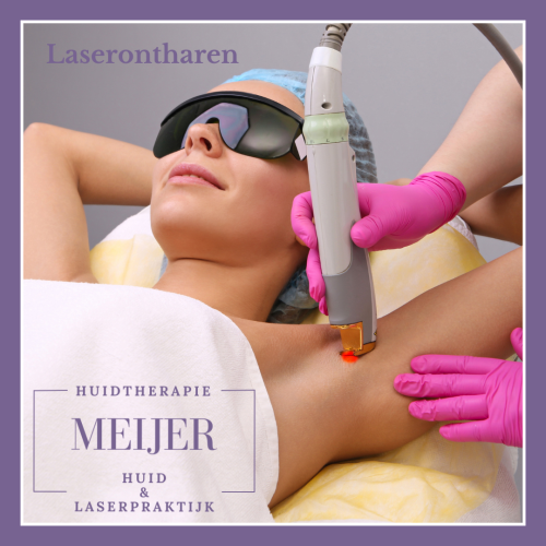 Laserontharen_20241125_200801_0000 Laserontharen_20241125_200801_0000